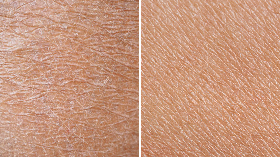 Moisturize and support with Restore.